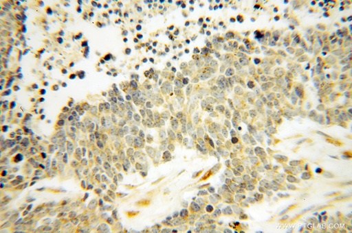 [14811-1-AP-20UL] DEXI Polyclonal antibody