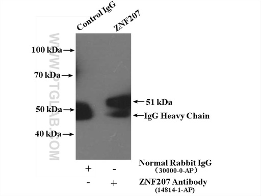 [14814-1-AP-150UL] ZNF207 Polyclonal antibody