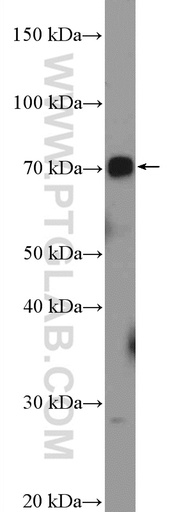 [14815-1-AP-150UL] UBOX5 Polyclonal antibody