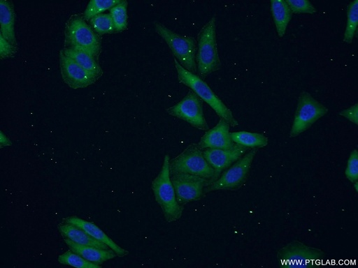 [14816-1-AP-20UL] PEX16 Polyclonal antibody