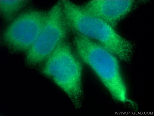 [14817-1-AP-20UL] HMOX2 Polyclonal antibody