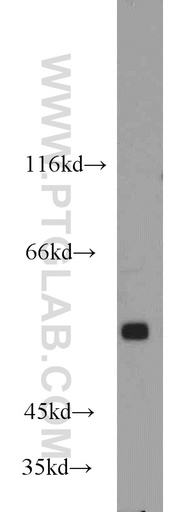 [14820-1-AP-150UL] GPR37/Pael-R Polyclonal antibody