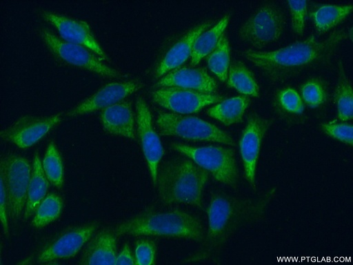 [14826-1-AP-150UL] RPL35 Polyclonal antibody