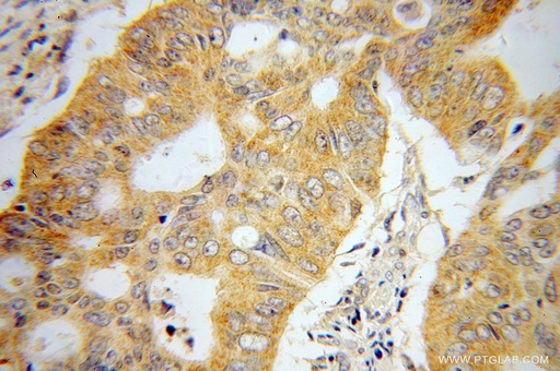 [14830-1-AP-20UL] UMPS Polyclonal antibody