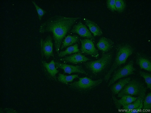 [14831-1-AP-20UL] RPS24 Polyclonal antibody