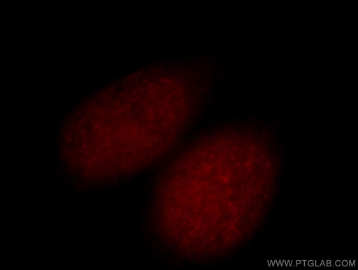 [14833-1-AP-20UL] GLYR1 Polyclonal antibody