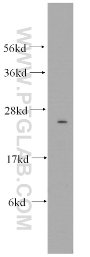 [14842-1-AP-20UL] Connexin-26 Polyclonal antibody