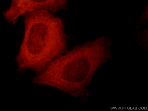 [14849-1-AP-150UL] KLHL14-Specific Polyclonal antibody
