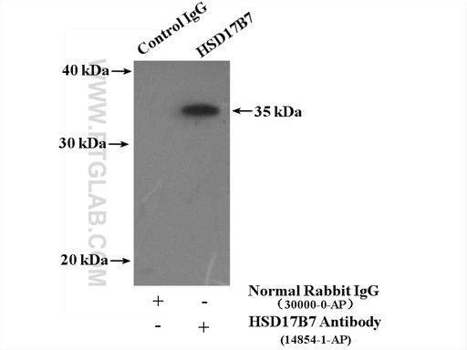[14854-1-AP-150UL] HSD17B7 Polyclonal antibody