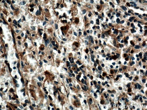 [14858-1-AP-20UL] SYK Polyclonal antibody