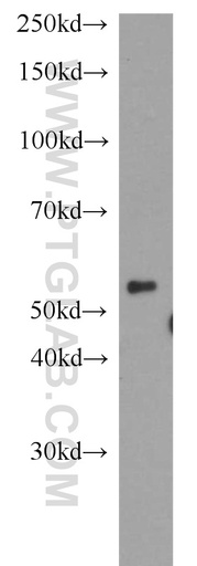 [14866-1-AP-150UL] DPH2 Polyclonal antibody