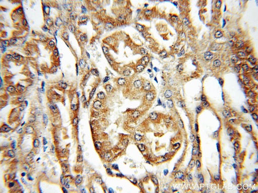 [14870-1-AP-20UL] PPOX Polyclonal antibody