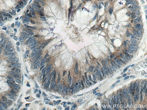 [14875-1-AP-20UL] SCLT1 Polyclonal antibody