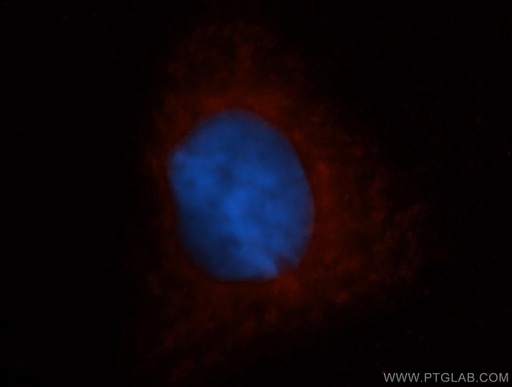 [14877-1-AP-20UL] DHODH Polyclonal antibody