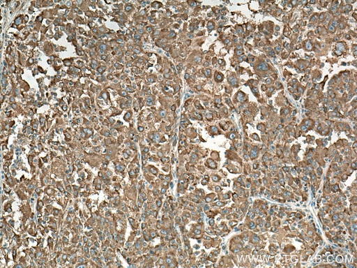 [14882-1-AP-150UL] NARS Polyclonal antibody