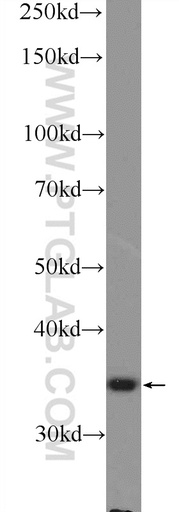 [14885-1-AP-20UL] NGRN Polyclonal antibody