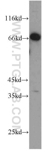 [14888-1-AP-150UL] C1orf116 Polyclonal antibody