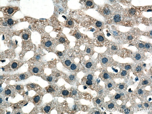 [14889-1-AP-150UL] GSTZ1 Polyclonal antibody