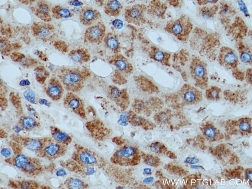 [14893-1-AP-20UL] ATP5D Polyclonal antibody