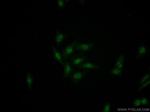 [14896-1-AP-20UL] RRP1 Polyclonal antibody