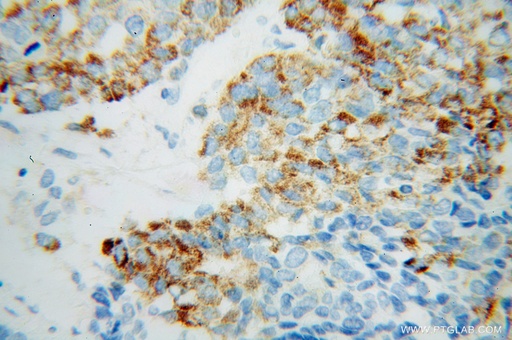 [14901-1-AP-20UL] PECR Polyclonal antibody