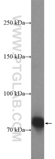 [14902-1-AP-150UL] HKR1 Polyclonal antibody