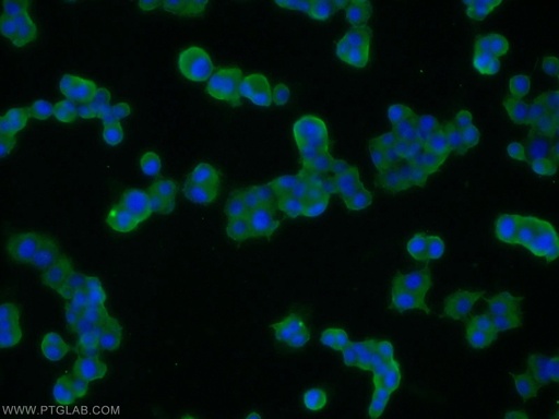 [14903-1-AP-150UL] SNAP25 Polyclonal antibody