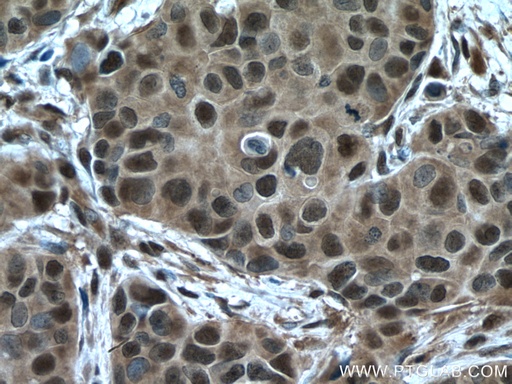 [14905-1-AP-150UL] PSMC2 Polyclonal antibody