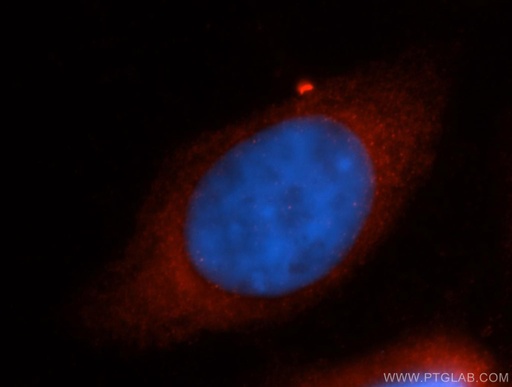 [14909-1-AP-20UL] RPS26 Polyclonal antibody