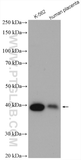[14910-1-AP-150UL] SERPINB9 Polyclonal antibody