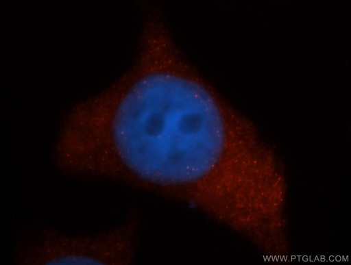 [14913-1-AP-20UL] UROS Polyclonal antibody