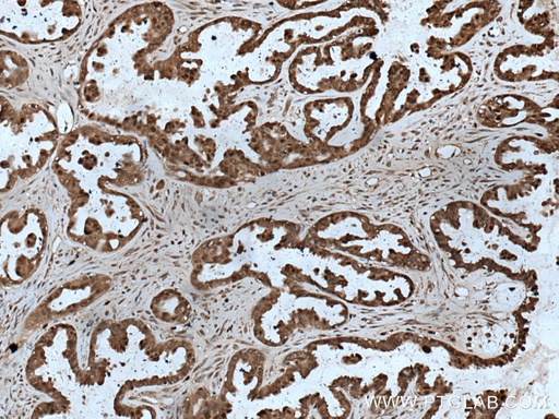 [14914-1-AP-150UL] HN1 Polyclonal antibody