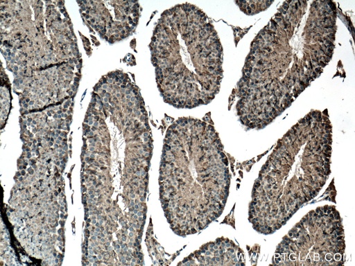 [14916-1-AP-20UL] DDOST Polyclonal antibody