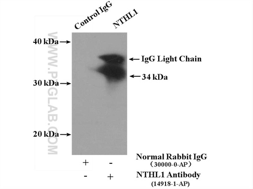[14918-1-AP-20UL] NTHL1 Polyclonal antibody