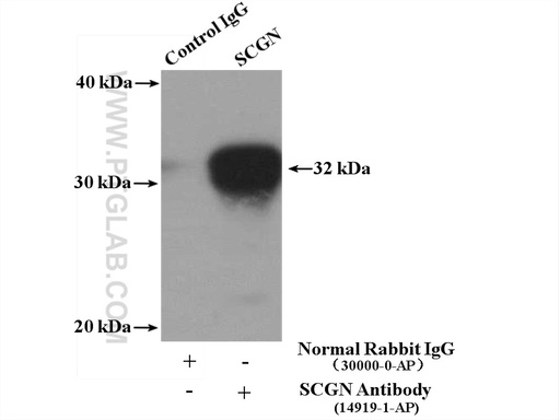 [14919-1-AP-150UL] SCGN Polyclonal antibody