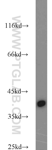 [14937-1-AP-20UL] URAT1 Polyclonal antibody