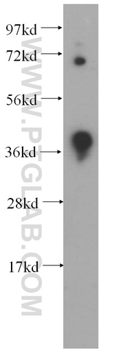[14939-1-AP-20UL] DNMT3L Polyclonal antibody
