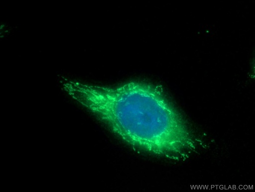 [14941-1-AP-150UL] BLMH Polyclonal antibody