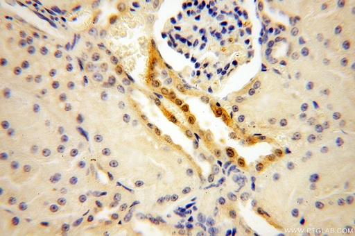 [14943-1-AP-20UL] OVCA2 Polyclonal antibody