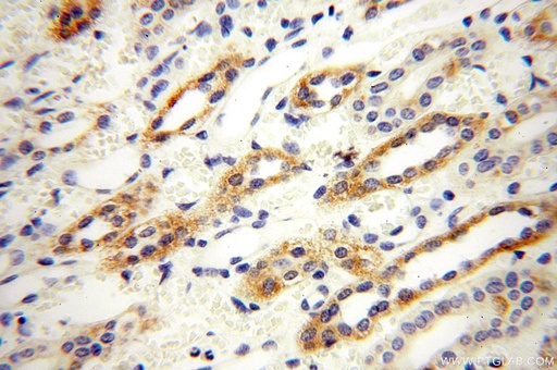 [14944-1-AP-150UL] GGPS1 Polyclonal antibody