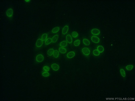 [14947-1-AP-150UL] Cyclon/CCDC86 Polyclonal antibody