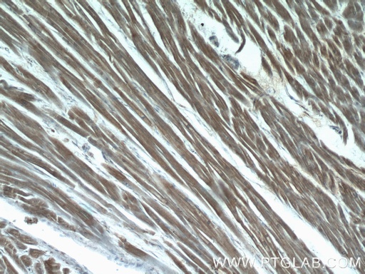 [14948-1-AP-150UL] LMOD3 Polyclonal antibody