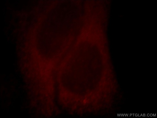 [14954-1-AP-150UL] Kir6.1 Polyclonal antibody