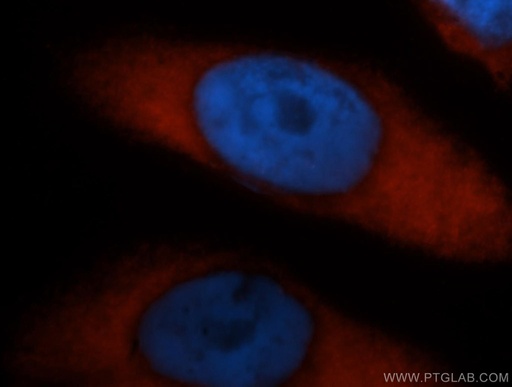 [14960-1-AP-20UL] PABPC4 Polyclonal antibody