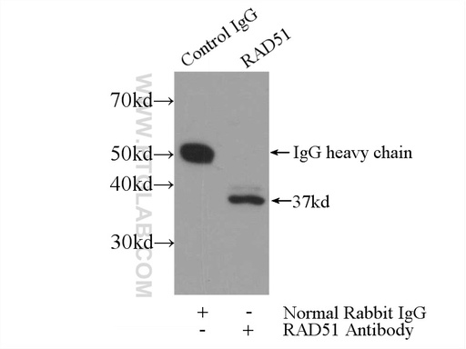[14961-1-AP-20UL] RAD51 Polyclonal antibody