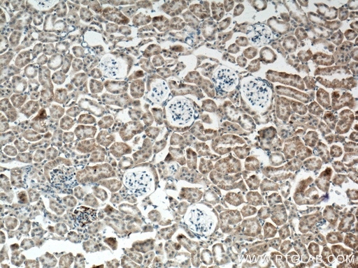 [14963-1-AP-20UL] SLC25A39 Polyclonal antibody