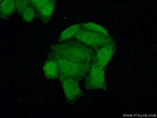 [14964-1-AP-20UL] POP7 Polyclonal antibody