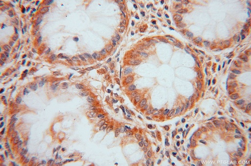 [14966-1-AP-150UL] DDAH2 Polyclonal antibody