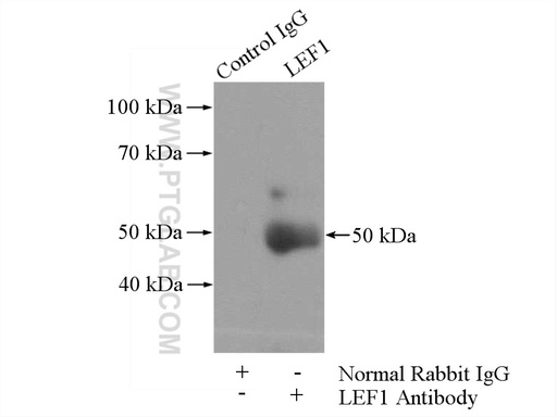 [14972-1-AP-150UL] LEF1 Polyclonal antibody