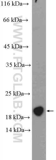 [14984-1-AP-20UL] MCTS1 Polyclonal antibody